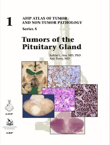 Бумажная книга «Tumors of the Pituitary Gland», авторов Арье Перри, Сильвия Л. Аса - фото №1