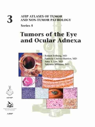 Паперова книга «Tumors of the Eye and Ocular Adnexa», авторів Емі Й. Лін, Патриція Чевес-Барріос, Роберт Фольберг, Тетяна Міллман - фото №1