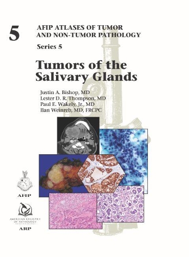 Бумажная книга «Tumors of the Salivary Glands», авторов Илан Вайнреб, Джастин А. Бишоп, Лестер Д. Р. Томпсон - фото №1
