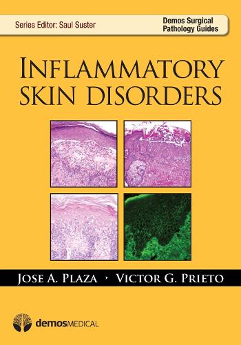 Паперова книга «Inflammatory Skin Disorders», авторів Хосе А. Плаза, Віктор Г. Прієто - фото №1