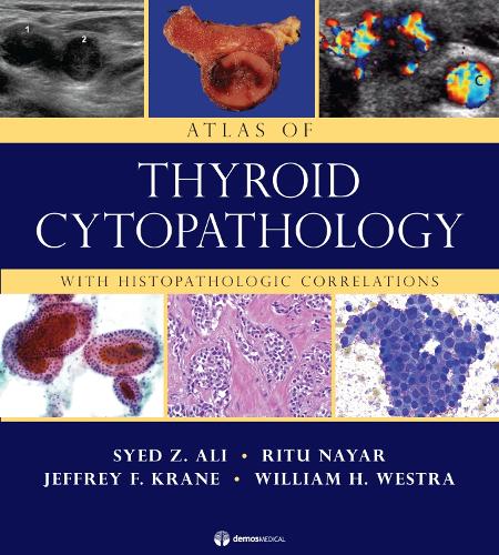 Бумажная книга «Atlas of Thyroid Cytopathology: With Histopathologic Correlations», авторов Джеффри Крейн, Риту Найяр, Саид Али, Уильям Уэстра - фото №1