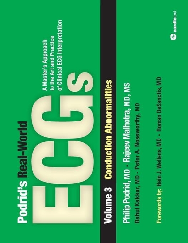 Паперова книга «Podrid's Real-World ECGs: Volume 3, Conduction Abnormalities», авторів Філіп Подрід, Рахул Яккар - фото №1
