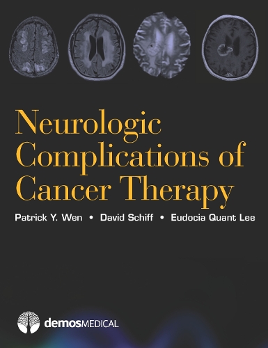 Бумажная книга «Neurologic Complications of Cancer Therapy», авторов Дэвид Шифф, Евдокия Квант Ли, Патрик Вен - фото №1