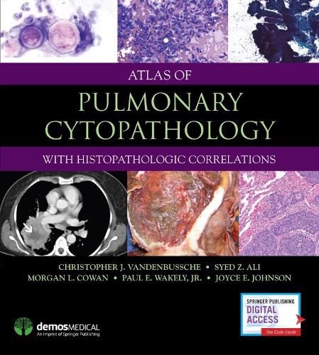 Паперова книга «Atlas of Pulmonary Cytopathology: With Histopathologic Correlations», авторів Крістофер Дж. ВанденБуше, Джойс Е. Джонсон, Морган Е. Кован, Пол Е. Вейклі-молодший, Саїд З. Алі - фото №1