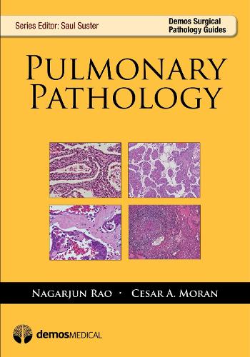 Паперова книга «Pulmonary Pathology», авторів Сезар А. Моран, Нагарджун Рао - фото №1