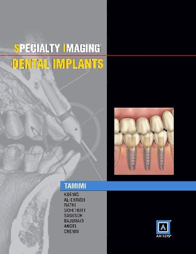Паперова книга «Specialty Imaging: Dental Implants», автор Данія Тамімі - фото №1