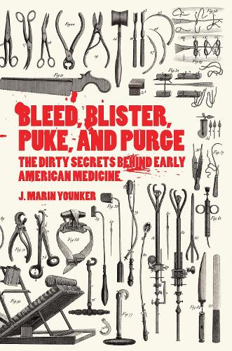 Бумажная книга «Bleed, Blister, Puke, and Purge: America's Medical Middle Ages», автор Дж. М. Юнкер - фото №1