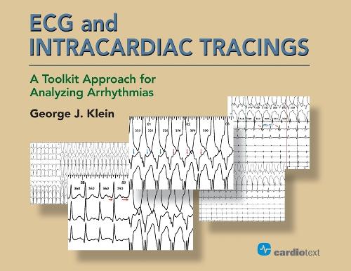 Бумажная книга «ECG and Intracardiac Tracings: A Toolkit Approach for Analyzing Arrhythmias», автор Джордж Дж. Клейн - фото №1