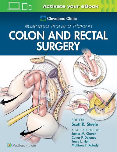 Бумажная книга «Cleveland Clinic Illustrated Tips and Tricks in Colon and Rectal Surgery», автор Скотт Стил - фото №1