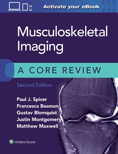Бумажная книга «Musculoskeletal Imaging: A Core Review», авторов Франческа Биман, Густав Блумквист, Джастин Монтгомери, Мэтью Максвелл, Пол Спайсер - фото №1