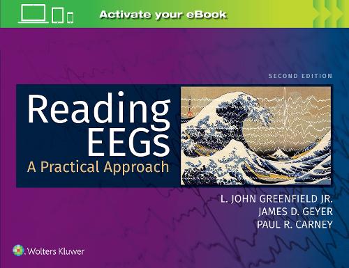 Бумажная книга «Reading EEGs: A Practical Approach», авторов Джеймс Д. Гейер, Л. Джон Гринфилд, Пол Р. Карни - фото №1
