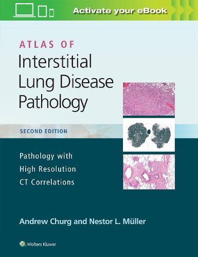 Бумажная книга «Atlas of Interstitial Lung Disease Pathology», авторов Эндрю Чург, Нестор Л. Мюллер - фото №1