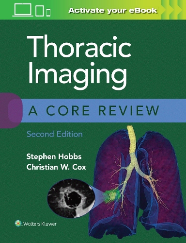 [object Object] «Thoracic Imaging: A Core Review», автор Кристиан Кокс - фото №1