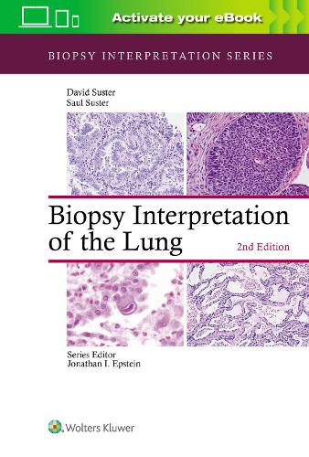 Бумажная книга «Biopsy Interpretation of the Lung», авторов Дэвид Састер, Сол Састер - фото №1