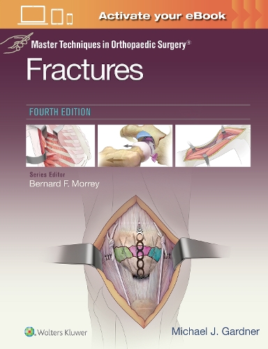 Паперова книга «Master Techniques in Orthopaedic Surgery: Fractures», автор Майкл Дж. Гарднер - фото №1