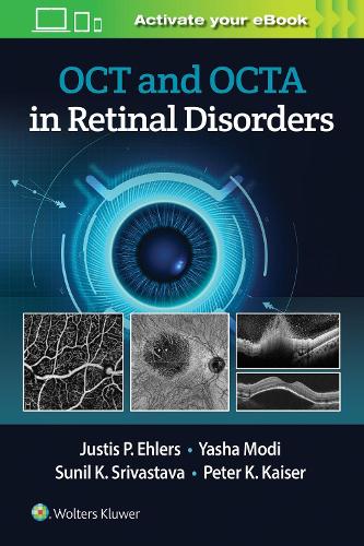 Бумажная книга «OCT and OCTA in Retinal Disorders», автор Джастис П. Элерс - фото №1
