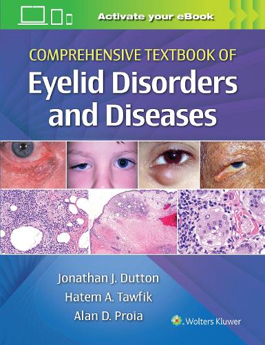 Бумажная книга «Comprehensive Textbook of Eyelid Disorders and Diseases», авторов Алан Пройа, Хатем Тауфик, Джонатан Даттон - фото №1