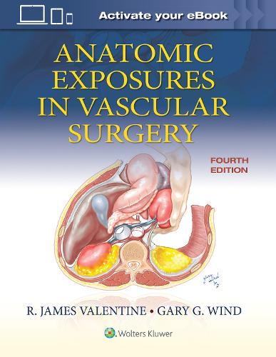 Бумажная книга «Anatomic Exposures in Vascular Surgery», авторов Гэри Г. Уинд, Р. Джеймс Валентайн - фото №1