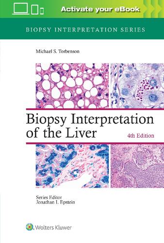 Бумажная книга «Biopsy Interpretation of the Liver», автор Майкл Торбенсон - фото №1