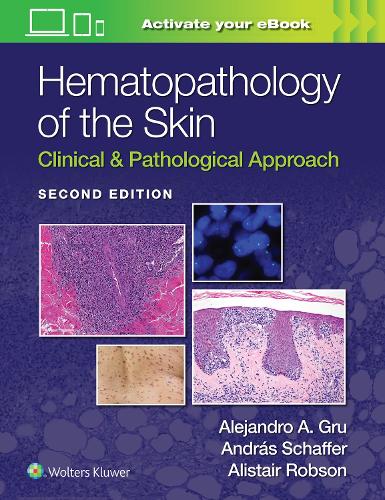 Паперова книга «Hematopathology of the Skin: Clinical & Pathological Approach», авторів Алістер Робсон, Андраш Шаффер, Алехандро Аріель Гру - фото №1