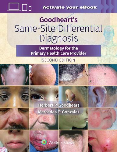 Бумажная книга «Goodheart's Same-Site Differential Diagnosis: Dermatology for the Primary Health Care Provider», автор Герберт Гудхарт - фото №1
