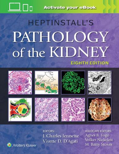 Паперова книга «Heptinstall's Pathology of the Kidney», авторів Дж. Чарльз Дженнетт, Віветт Д. Д'Агаті - фото №1