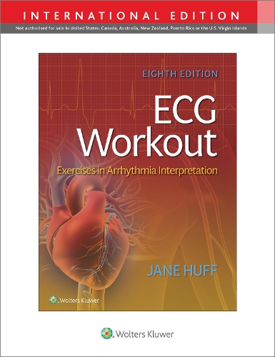 Бумажная книга «ECG Workout: Exercises in Arrythmia Interpretation», автор Джейн Хафф - фото №1