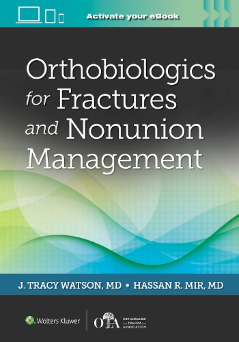 Паперова книга «Orthobiologics for Fractures and Nonunion Management», автор Дж. Трейсі Вотсон - фото №1