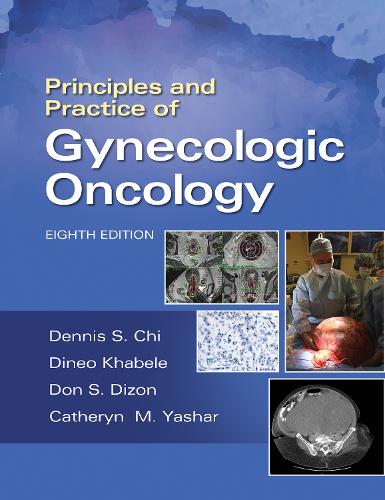 Бумажная книга «Principles and Practice of Gynecologic Oncology», автор Дон С. Дизон - фото №1