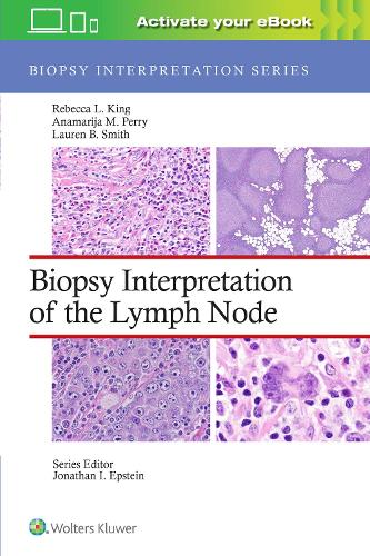 Паперова книга «Biopsy Interpretation of the Lymph Node», авторів Анамарія М. Перрі, Лорен Б. Сміт, Ребекка Лі Кінг - фото №1