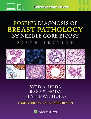 Бумажная книга «Rosen's Diagnosis of Breast Pathology by Needle Core Biopsy», авторов Элейн Чжун, Раза С. Хода, Сайед А. Хода - фото №1