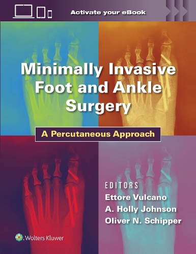 Бумажная книга «Minimally Invasive Foot and Ankle Surgery: A Percutaneous Approach», автор А. Холланд Джонсон - фото №1