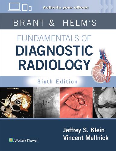 [object Object] «Brant & Helms' Fundamentals of Diagnostic Radiology: Print + eBook with Multimedia», автор Джеффри Клейн - фото №1