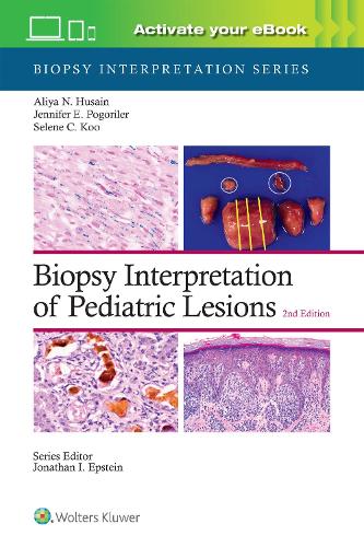 Бумажная книга «Biopsy Interpretation of Pediatric Lesions: Print + eBook with Multimedia», автор Алия Нур Хусаин - фото №1