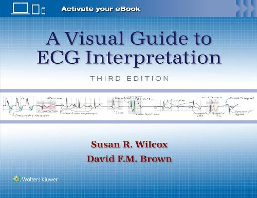 Бумажная книга «A Visual Guide to ECG Interpretation: Print + eBook with Multimedia», авторов Дэвид Ф. М. Браун, Сьюзан Рене Уилкокс - фото №1