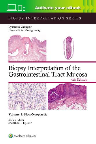[object Object] «Biopsy Interpretation of the Gastrointestinal Tract Mucosa Volume 1: Non-Neoplastic: Print + eBook with Multimedia», автор Лисандра Вольтаджио - фото №1