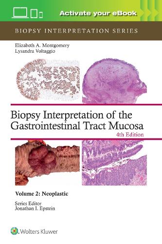 [object Object] «Biopsy Interpretation of the Gastrointestinal Tract Mucosa Volume 2: Neoplastic: Print + eBook with Multimedia», автор Лисандра Вольтаджио - фото №1