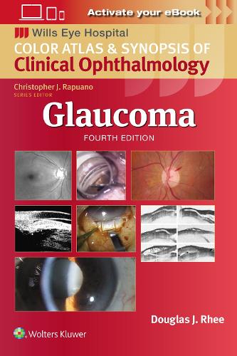 Паперова книга «Glaucoma», автор Дуглас Дж. Рі - фото №1