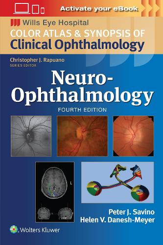 Бумажная книга «Neuro-Ophthalmology: Print + eBook with Multimedia», автор Питер Дж. Савино - фото №1