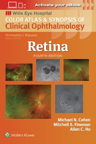 Бумажная книга «Retina», автор Митчелл С. Файнман - фото №1