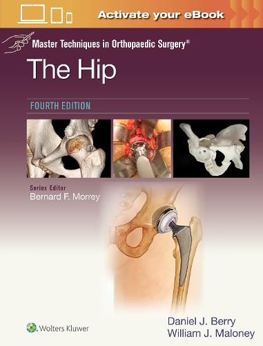 Паперова книга «Master Techniques in Orthopaedic Surgery: The Hip: Print + eBook with Multimedia», авторів Деніел Джон Беррі, Вільям Джозеф Малоні - фото №1