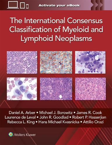 Бумажная книга «The International Consensus Classification of Myeloid and Lymphoid Neoplasms», автор Дэниел А. Арбер - фото №1