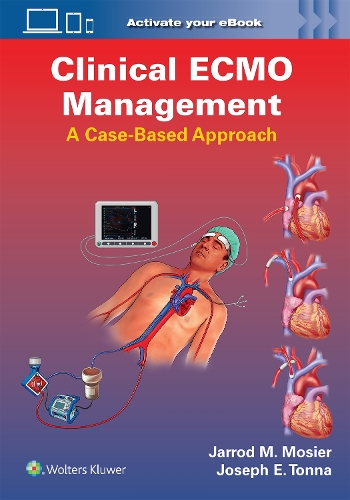 Паперова книга «Clinical ECMO Management: A Case-Based Approach», авторів Джаррод Мозьєр, Джозеф Едвард Тонна - фото №1