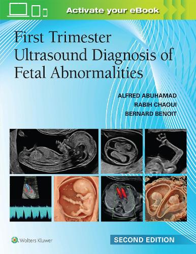 Паперова книга «First Trimester Ultrasound Diagnosis of Fetal Abnormalities», авторів Альфред З. Абухамад, Бернар Бенуа, Рабіх Чауї - фото №1