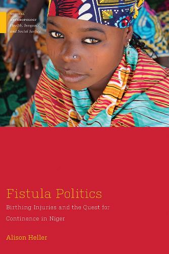 Паперова книга «Fistula Politics: Birthing Injuries and the Quest for Continence in Niger», автор Елісон Хеллер - фото №1