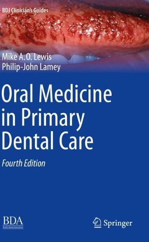 Бумажная книга «Oral Medicine in Primary Dental Care», авторов Майкл А. О. Льюис, Филипп-Джон Ламей - фото №1