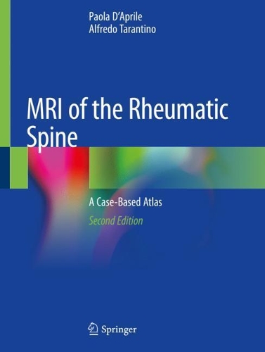 Паперова книга «MRI of the Rheumatic Spine: A Case-Based Atlas», авторів Альфредо Тарантіно, Паола Д'Апріле - фото №1