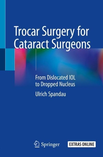 Паперова книга «Trocar Surgery for Cataract Surgeons: From Dislocated IOL to Dropped Nucleus», автор Ульріх Шпандау - фото №1