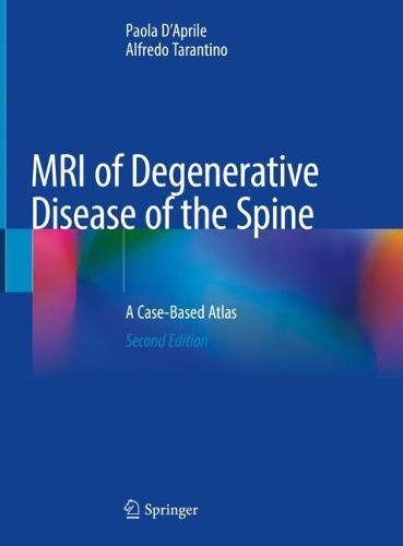 Паперова книга «MRI of Degenerative Disease of the Spine: A Case-Based Atlas», авторів Альфредо Тарантіно, Паола Д'Апріле - фото №1