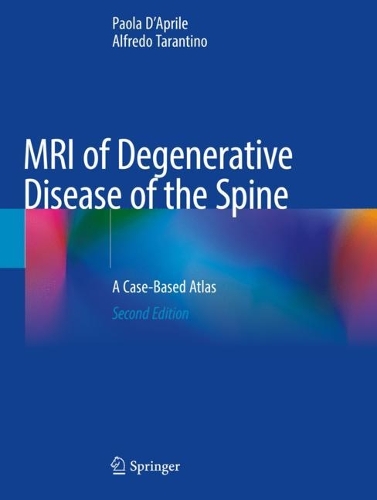 Паперова книга «MRI of Degenerative Disease of the Spine: A Case-Based Atlas», авторів Альфредо Тарантіно, Паола Д'Апріле - фото №1